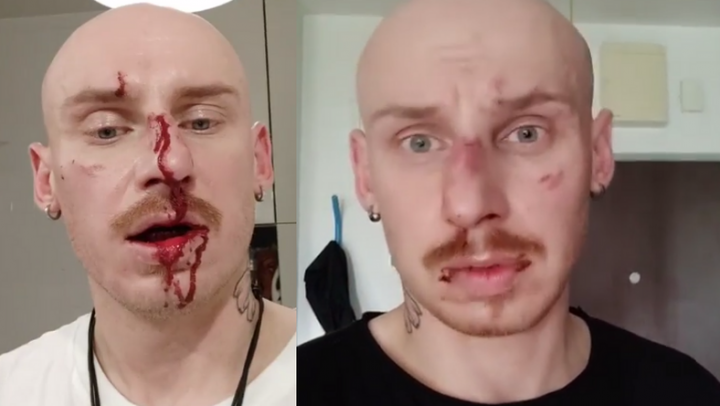 Jacek Szawioła z programu "Gogglebox. Przed telewizorem" został pobity