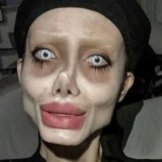 nieudane operacje plastyczne - Plejada.pl