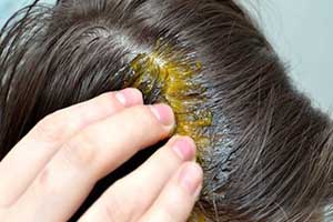 Kuracja na porost włosów zalewa rynek. Zwalcza łupież&nbsp;i zagęszcza